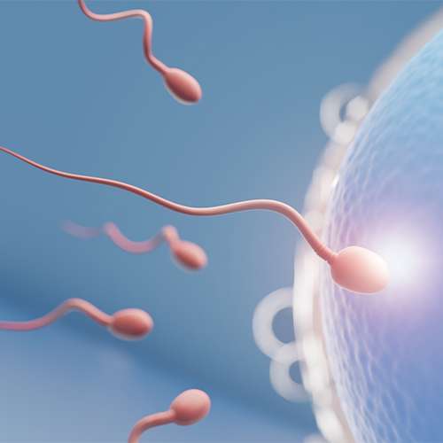 PCOS Infertility Treatment in Coimbatore